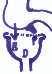x.jpg