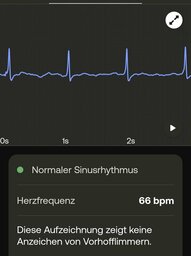 ekg.jpg